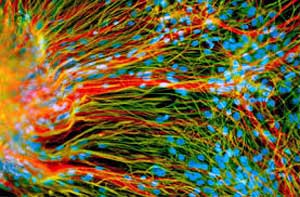कर्करोगाला नष्ट करणा-या प्रतिरोधक पेशीचा शोध