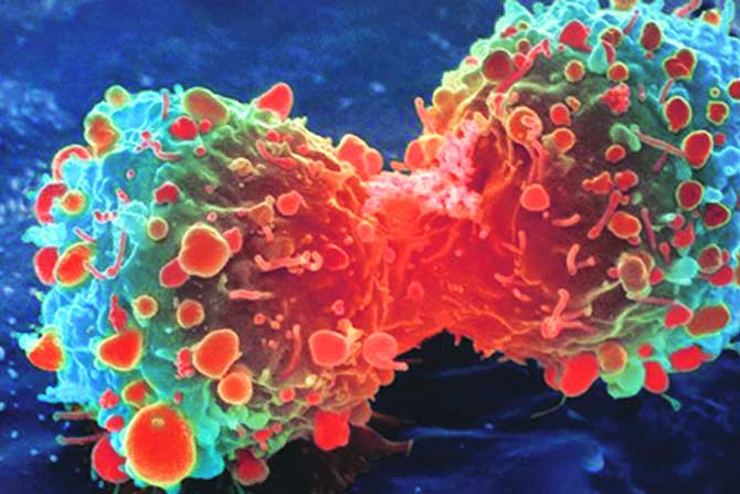 कर्करोगाच्या पेशीतील बदल टिपणारी यंत्रणा