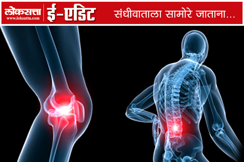 Osteoarthritis Cases, India, 60 Million, 2025
