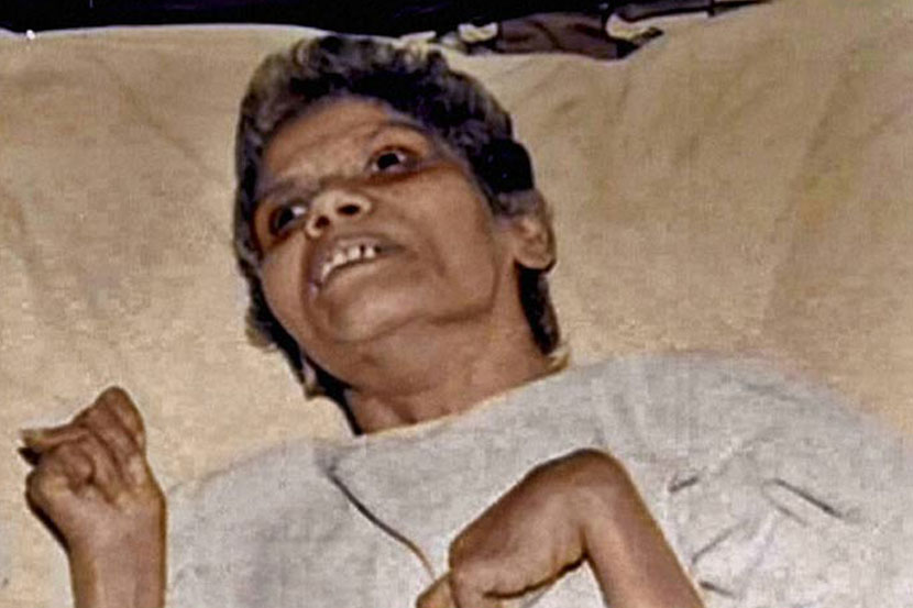 aruna shanbaug