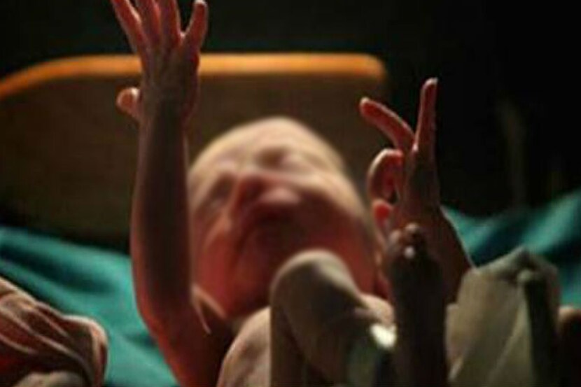 alive infant, alive infant, अर्भक