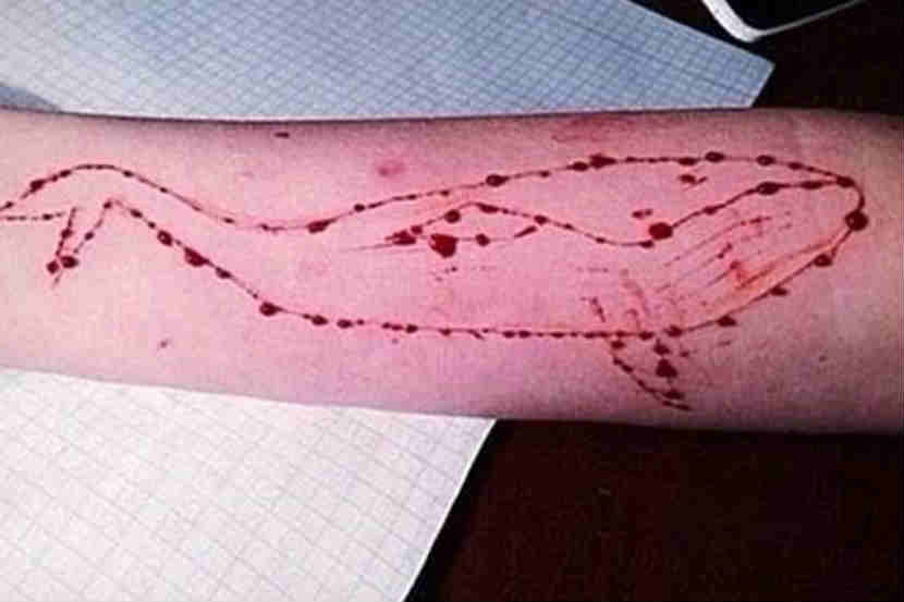 Blue whale game, suicide