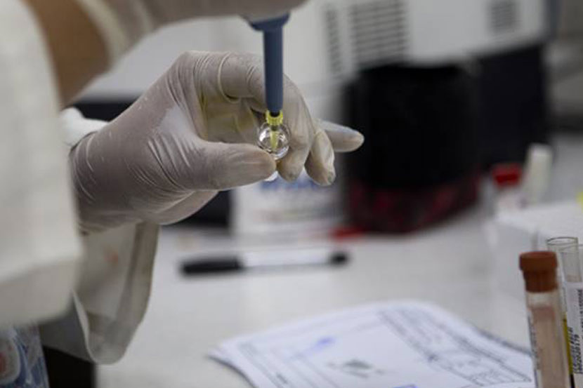 Malaria test