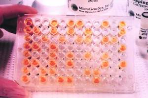 HIV infected blood