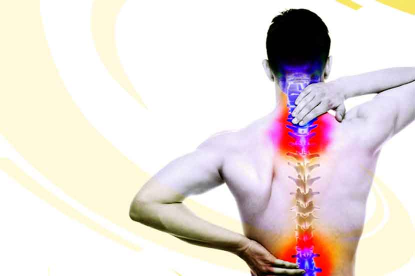 Spondylosis