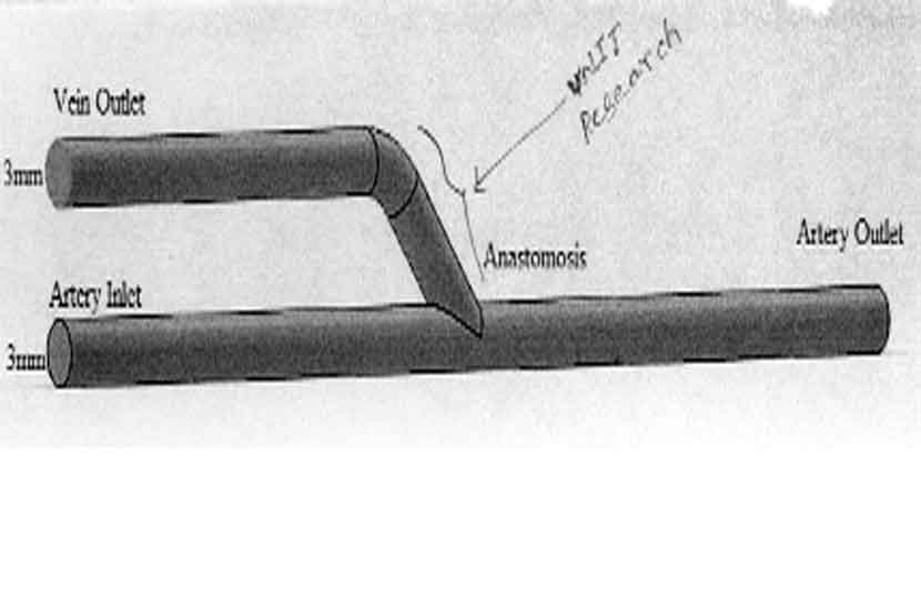 व्हीएनआयटीमध्ये तयार करण्यात आलेले कानाच्या मागील कृत्रिम हाड