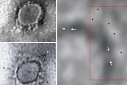 पुणे : एनआयव्हीच्या वैज्ञानिकांनी इलेक्ट्रॉनिक मायक्रोस्कोपखाली करोना विषाणूची प्रतिमा मिळवली आहे.