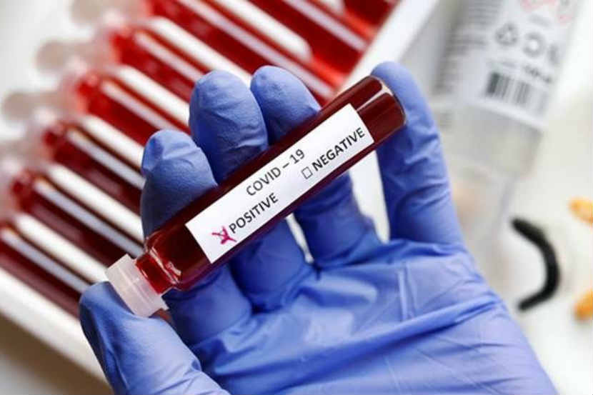 गुजरातमध्ये खळबळजनक घटना : करोना रुग्णाचा मृतदेह आढळला बस स्टँडवर