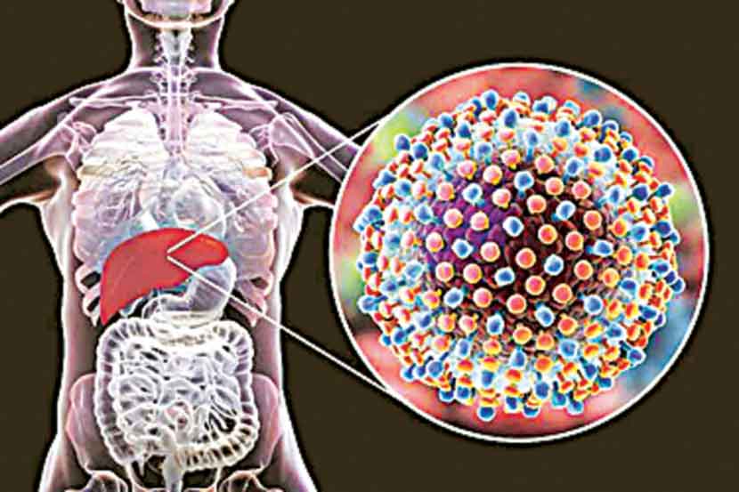 हेपटायटिस : विषाणूजन्य आजार