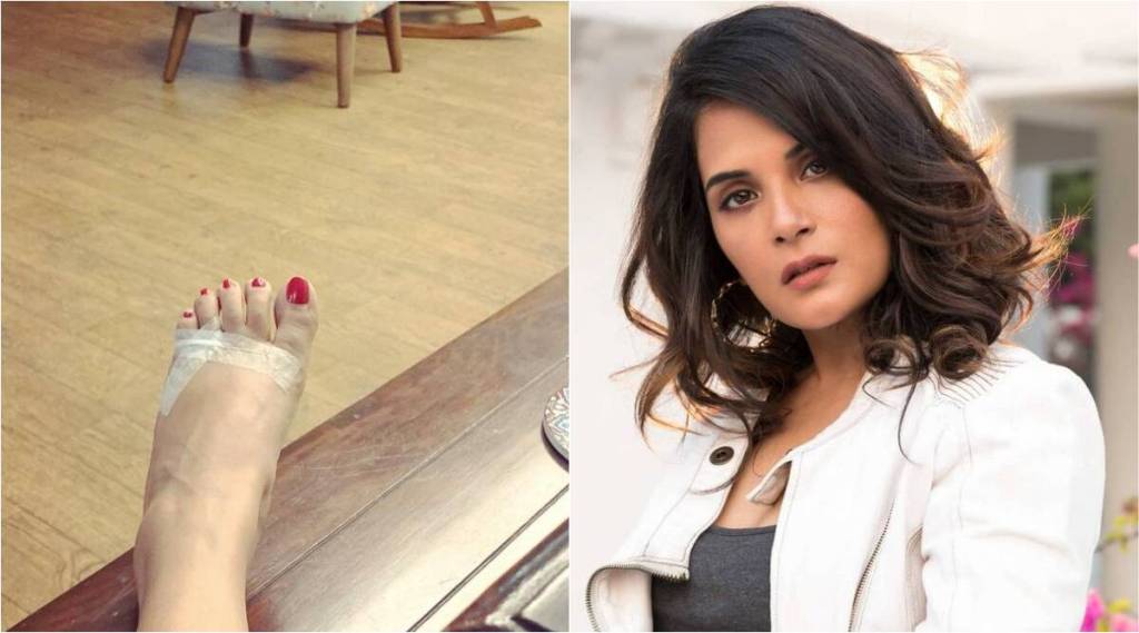 richa-chadha-foot-inury