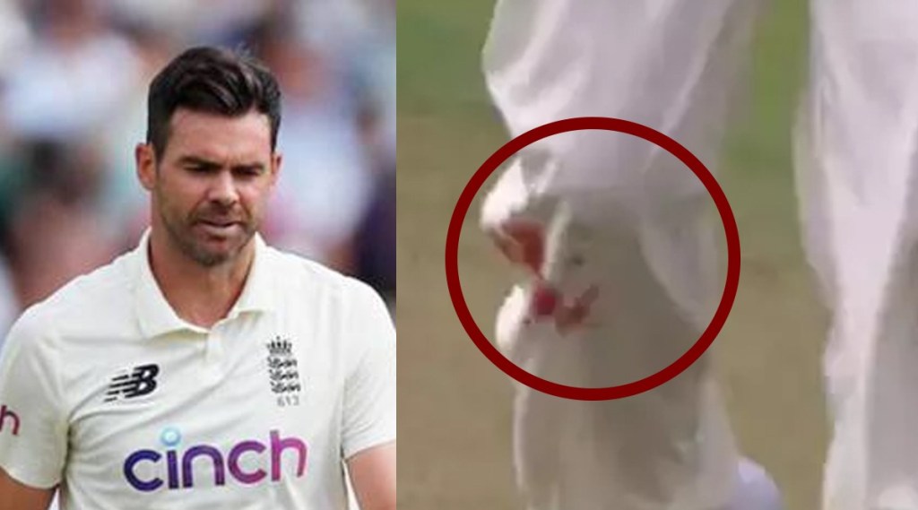 eng vs ind james anderson bowling with bleeding knee in oval test