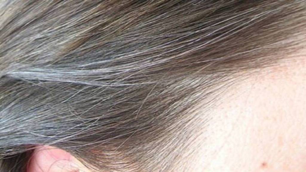 Hair Care Tips: लहान वयात केस पांढरे झालेत? जाणून घ्या कारणे आणि प्रतिबंध करण्याच्या पद्धती