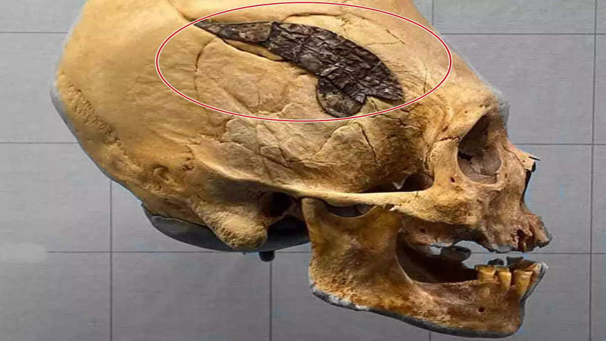 eleton surgery performed 2000 years