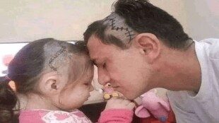 Viral_photo