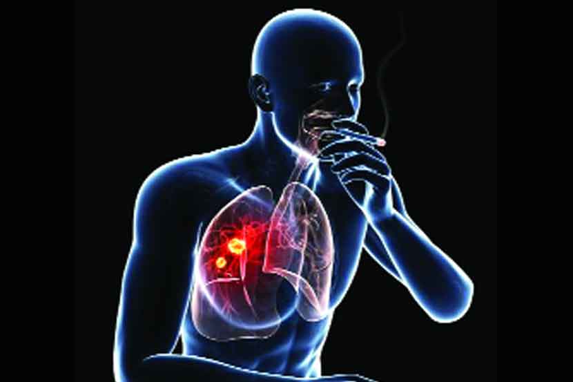 धुम्रपान हे खोकल्याचे प्रमुख कारण आहे. वास्तविक, तंबाखूमध्ये असलेल्या रासायनिक घटकांमुळे फुफ्फुसात जळजळ होते. खोकल्याद्वारे ही चिडचिड दूर करण्यासाठी शरीर श्लेष्मा बनवते. त्यामुळे रुग्णाला खूप खोकला येतो. धुम्रपान लवकर बंद केले नाही तर क्षय रोगासारखे इतर मोठे आजार होण्याचा धोका वाढतो.