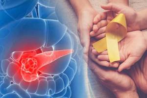 pancreatic-cancer