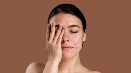 pimple skin freepik