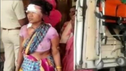 Injured Women In Tiger Attack