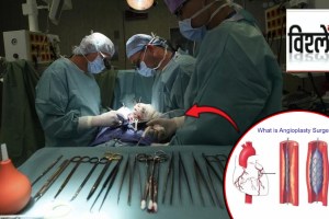 What is Angioplasty Surgery