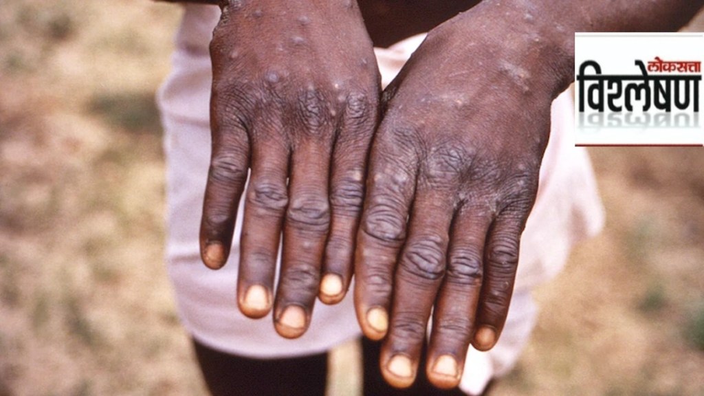 What is Monkeypox