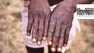 What is Monkeypox