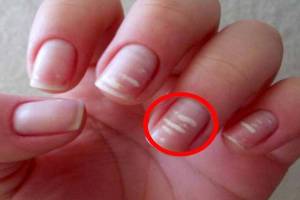 nails care