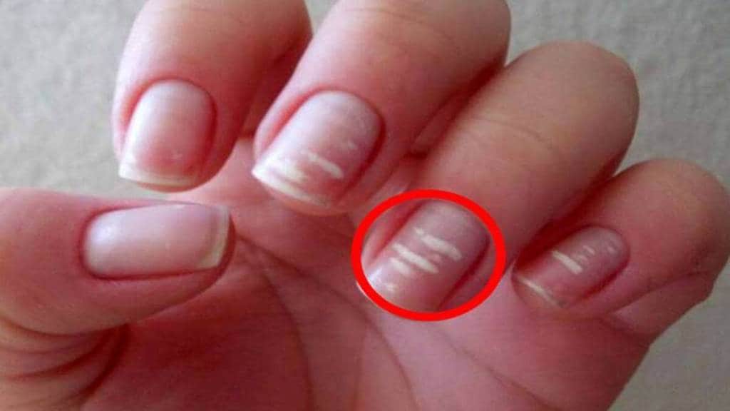 nail care