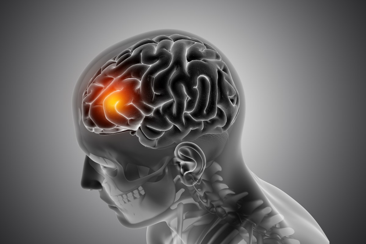 World Brain Tumour Day 2022
