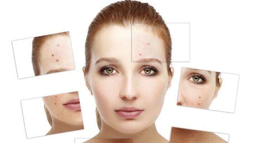 Skin Care Tips: चेहऱ्यावर मुरुमांचा त्रास होतोय? अशाप्रकारे घ्या काळजी