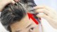 gray and white hair problem