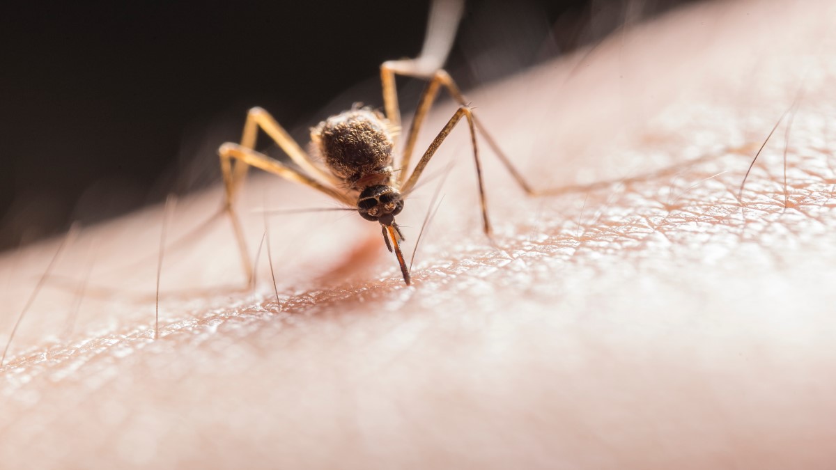 Easy Home Remedies to Get rid of Mosquitoes bites