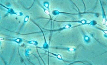 Sperm count decreases in men due to these 5 problems know how to improve it