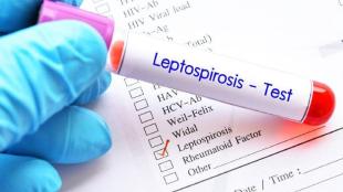 leptospirosis