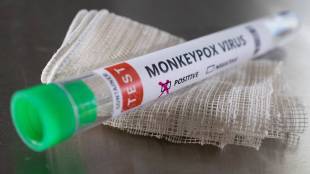Eight suspected people cleared of monkeypox, two patients test report awaited