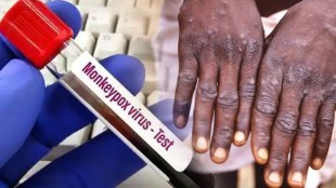 Know the do's and don'ts amid rising cases of monkeypox in India