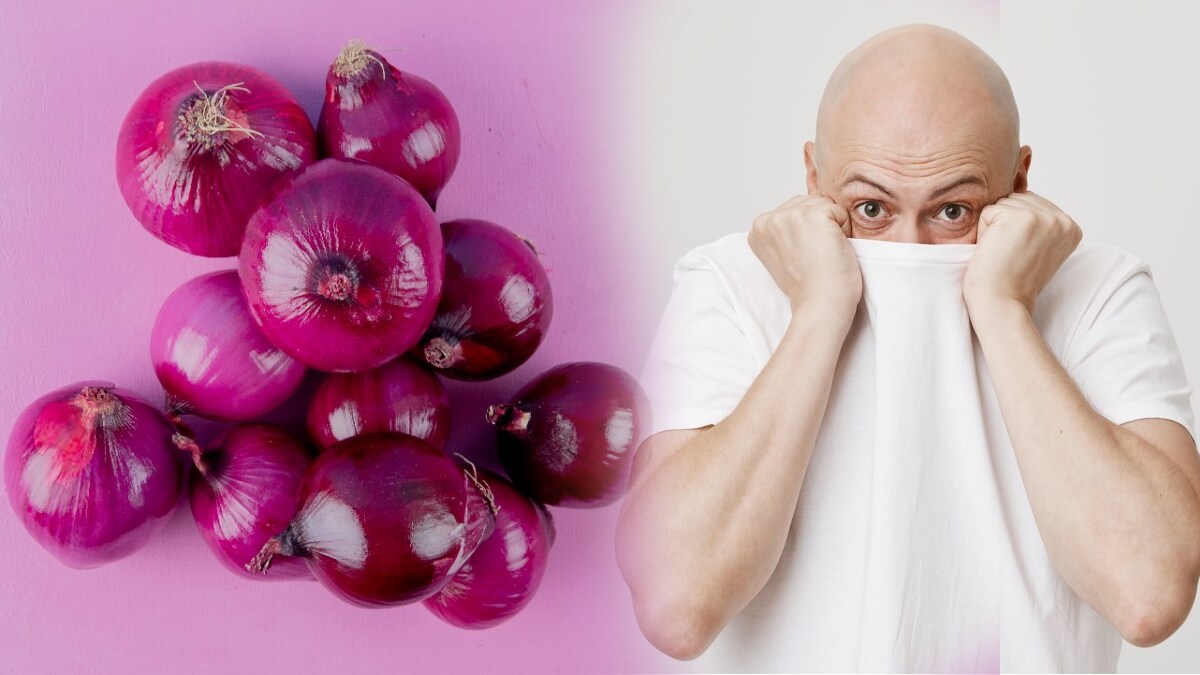 Onion will cure baldness problem