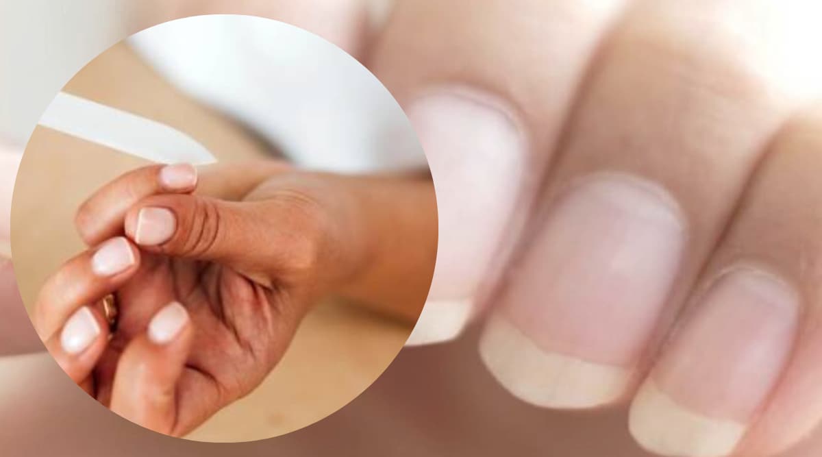 why my nail breaks These small changes in nails are symptoms of major diseases Be careful in time