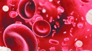 Increase in sickle cell patients in the state