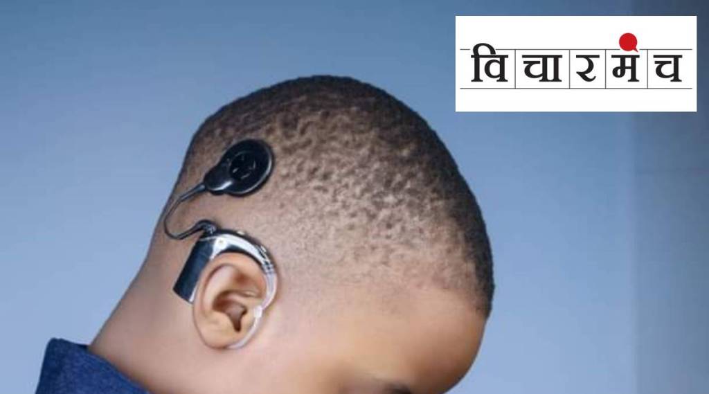 what has to do about very costly surgery of cochlear implant ( photo courtesy- social media )