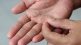 'These' serious reasons can be behind the peeling of the skin on the hands