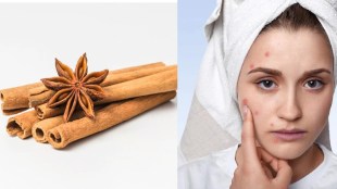 Cinnamon helps to get rid of pimples wrinkles acne know how to use it