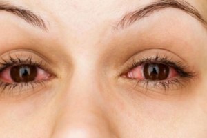 Eye-disease