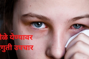 What is Dole Yene in English Know About Conjunctivitis symptoms home treatment ayurvedic upchar