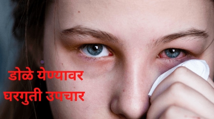 What is Dole Yene in English Know About Conjunctivitis symptoms home treatment ayurvedic upchar