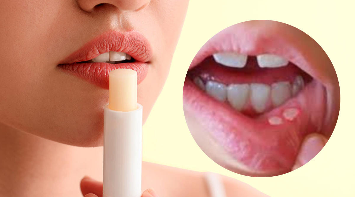 Lipstick Side Effects on Pregnancy Ayurvedic Herbal Lip Balm And Perfect Make up Tips