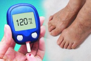 diabetes symptoms in legs