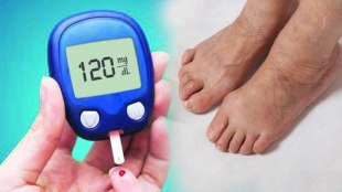 diabetes symptoms in legs