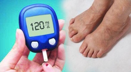 diabetes symptoms in legs