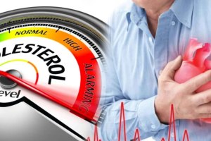 high cholesterol risk