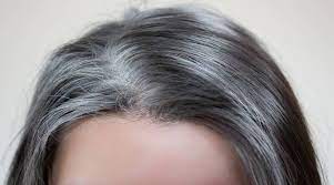 Covid19 Symptoms Hair Loss